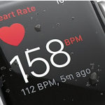 This Apple Watch Is Transforming The Way We Treat Heart Disease!