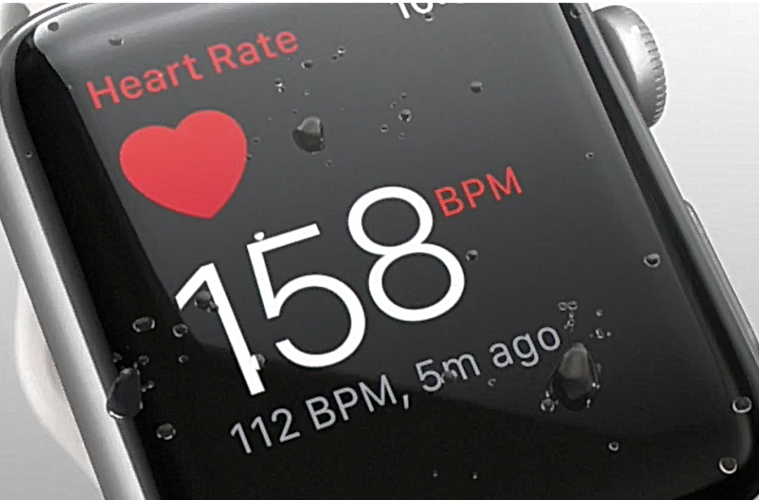 This Apple Watch Is Transforming The Way We Treat Heart Disease!